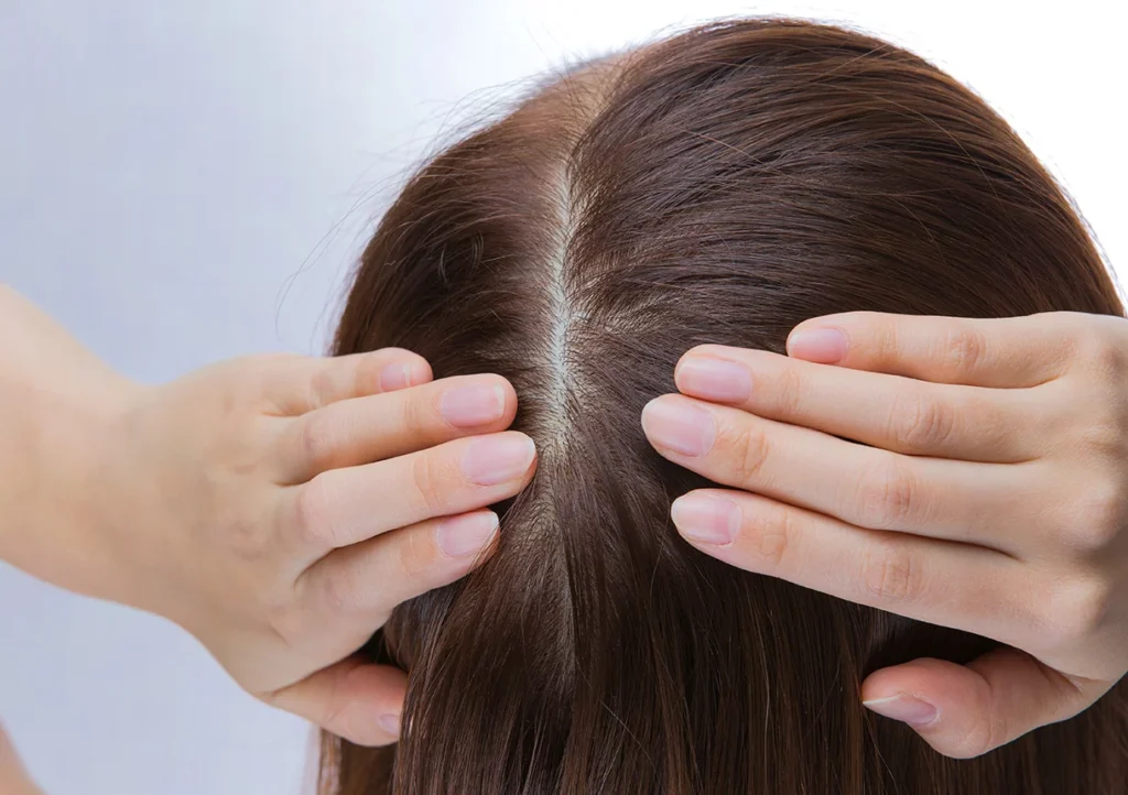 Kein Haarausfall bei Chemo schlechtes Zeichen – Fakten, Ursachen & Hoffnung kein haarausfall bei chemo schlechtes zeichen